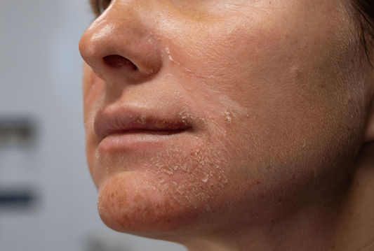 Serum for dry skin