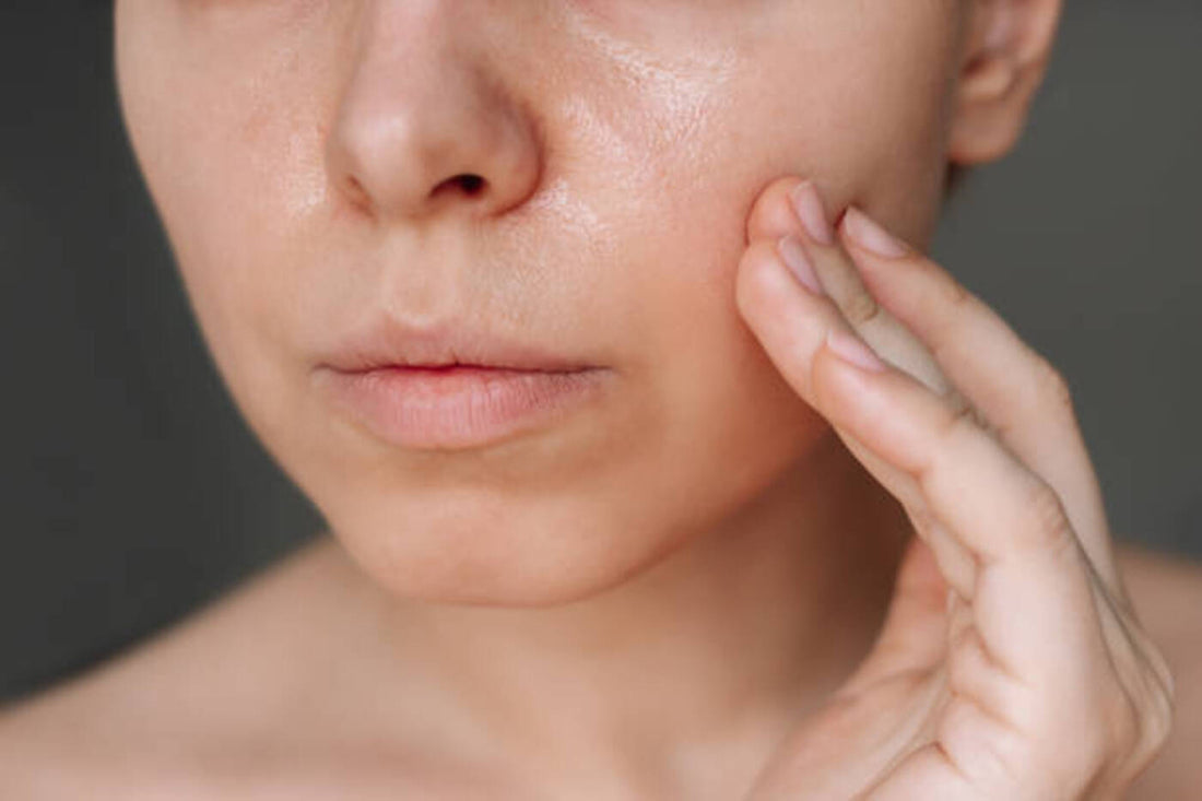 moisturizer for oily skin