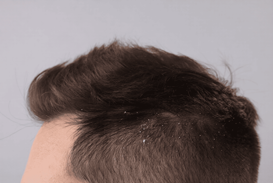Does Texture Powder Cause Hair Loss or Scalp Damage?