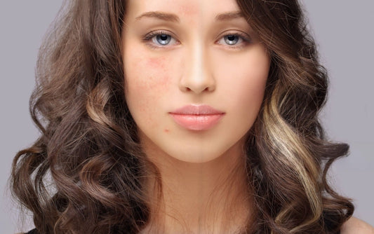 Moisturizer for Combination Skin