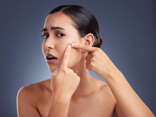 breakouts on face