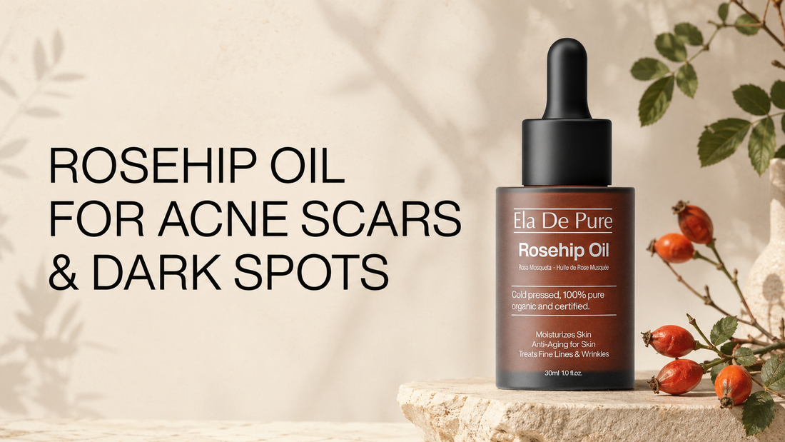 ELA DE PURE Rosehip Oil for acne scars and dark spots