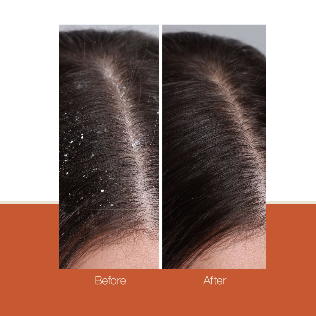 Deep Cleanse Shampoo