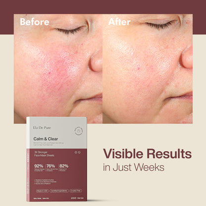 Calm & Clear Mask Sheet Set