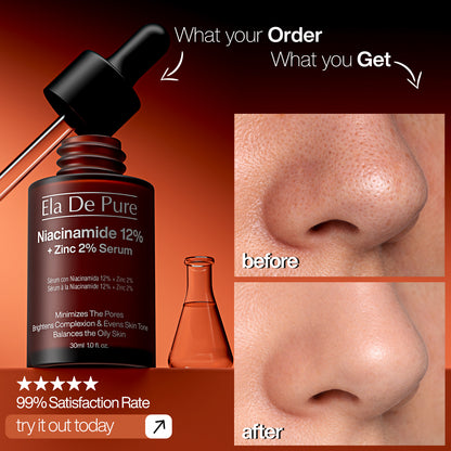 Niacinamide serum results