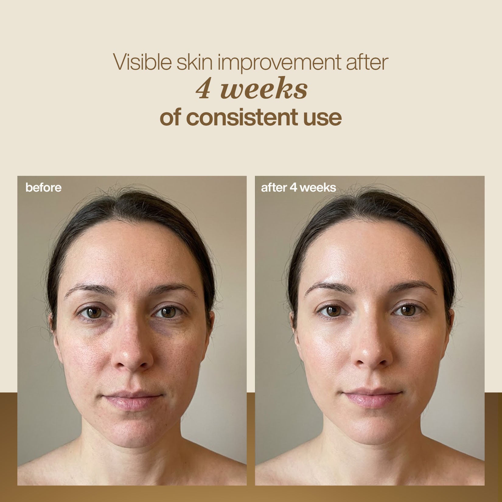Skin improvement with retinol face serum